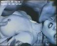 kidn018.jpg
